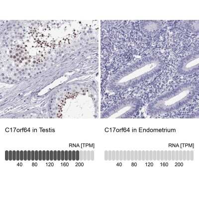 Immunohistochemistry-Paraffin: C17orf64 Antibody [NBP1-86197]