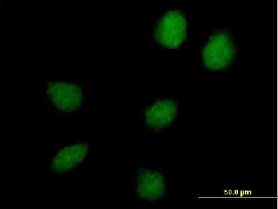 Immunocytochemistry/ Immunofluorescence: HEATR9 Antibody [H00256957-B01P]
