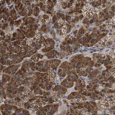 Immunohistochemistry-Paraffin: C17orf80 Antibody [NBP1-83637]