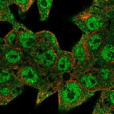 Immunocytochemistry/ Immunofluorescence: EPOP Antibody [NBP2-47535]