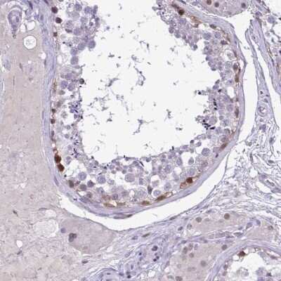 Immunohistochemistry-Paraffin: EPOP Antibody [NBP2-47535]