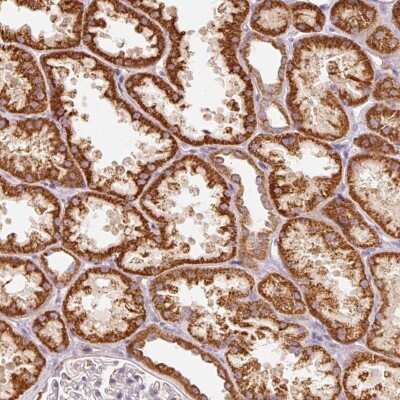 Immunohistochemistry: C17orf98 Antibody [NBP2-49016]