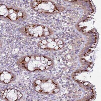 Immunohistochemistry-Paraffin: AKAIN1 Antibody [NBP2-14679]