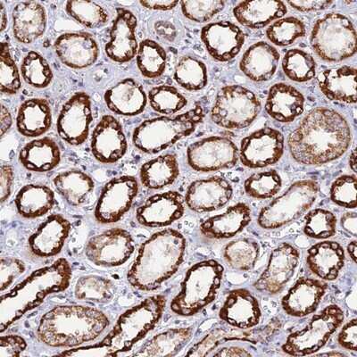 Immunohistochemistry-Paraffin: C19orf24 Antibody [NBP1-83638]