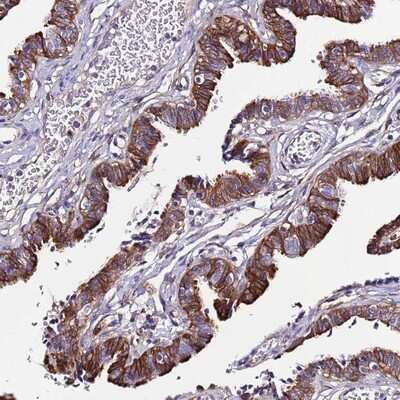 Immunohistochemistry-Paraffin: C19orf24 Antibody [NBP2-14800]