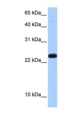 Western Blot: C19orf24 Antibody [NBP1-57556]