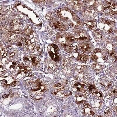 Immunohistochemistry-Paraffin: C19orf47 Antibody [NBP1-91722]