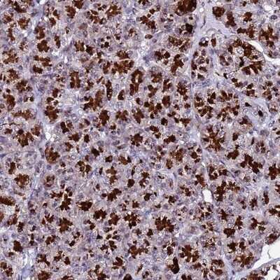 Immunohistochemistry-Paraffin: C19orf47 Antibody [NBP1-91723]