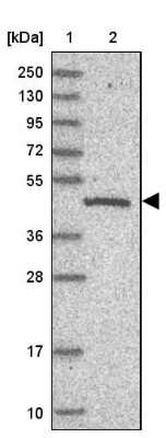Western Blot: C19orf47 Antibody [NBP1-91722]