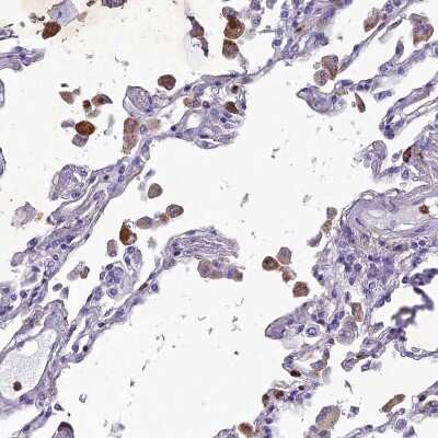 Immunohistochemistry-Paraffin: C19orf48 Antibody [NBP1-81210]