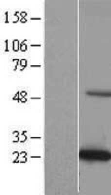 Western Blot: KxDL motif containing 1 Overexpression Lysate [NBL1-08275]