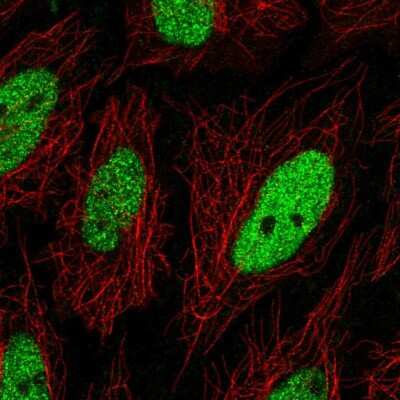 Immunocytochemistry/ Immunofluorescence: C19orf57 Antibody [NBP2-56114]