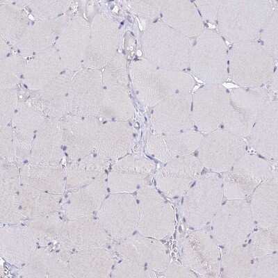 Immunohistochemistry-Paraffin: C19orf57 Antibody [NBP1-93524]