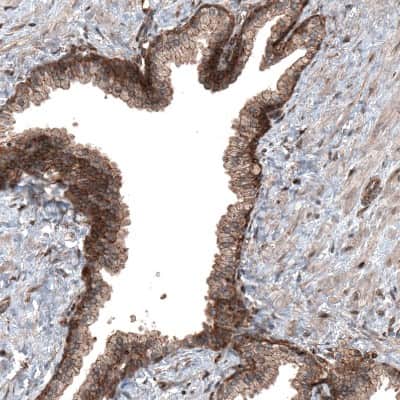 Immunohistochemistry-Paraffin: RyDEN Antibody [NBP1-90417]