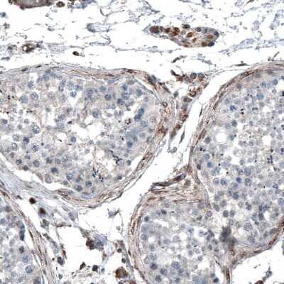 Immunohistochemistry-Paraffin: RyDEN Antibody [NBP1-90417]