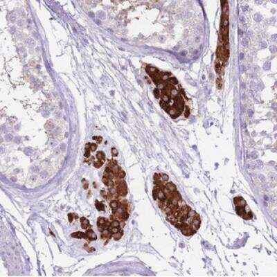 Immunohistochemistry: Glutamate Rich 4 Antibody [NBP2-30800]