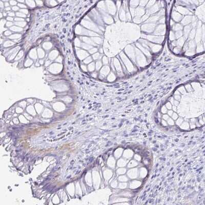 Immunohistochemistry-Paraffin: C19orf73 Antibody [NBP2-32367]