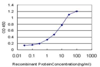 ELISA: C1D Antibody (6H2) [H00010438-M03]