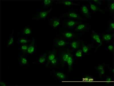Immunocytochemistry/ Immunofluorescence: C1D Antibody (6H2) [H00010438-M03]