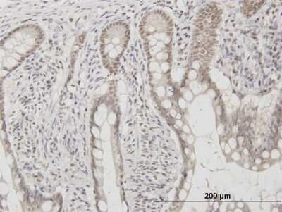 Immunohistochemistry-Paraffin: C1D Antibody (6H2) [H00010438-M03]