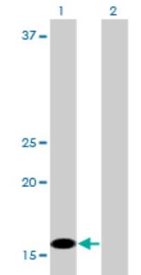 Western Blot: C1D Antibody (6H2) [H00010438-M03]