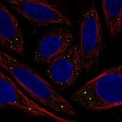 Immunocytochemistry/ Immunofluorescence: C1GALT1C1 Antibody [NBP3-17811]