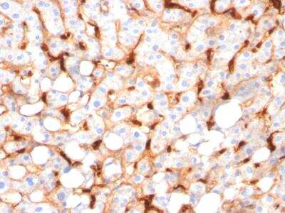 Immunohistochemistry-Paraffin: C1QB Antibody (C1QB/2966) - Azide and BSA Free [NBP2-79922]