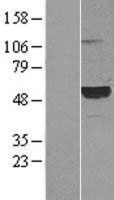 Western Blot: Complement Component C1rLP Overexpression Lysate [NBL1-08350]