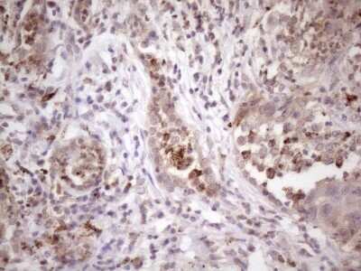 Immunohistochemistry: INAVA Antibody (OTI6A6) [NBP2-46597]