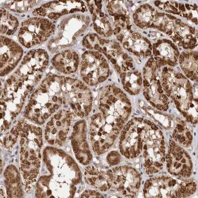 Immunohistochemistry-Paraffin: CCDC190 Antibody [NBP1-82672]