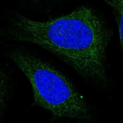 Immunocytochemistry/ Immunofluorescence: CZIB Antibody [NBP1-82173]