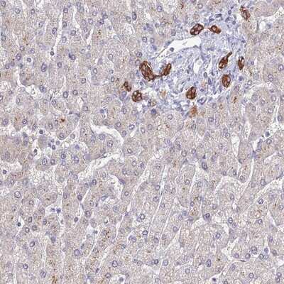 Immunohistochemistry-Paraffin: CZIB Antibody [NBP1-82173]
