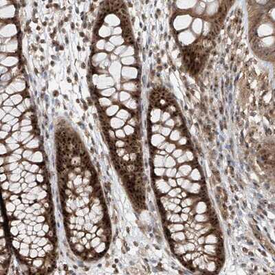 Immunohistochemistry-Paraffin: C1orf131 Antibody [NBP1-85097]