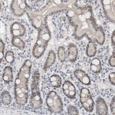 Immunohistochemistry-Paraffin: C1orf131 Antibody [NBP1-85098]