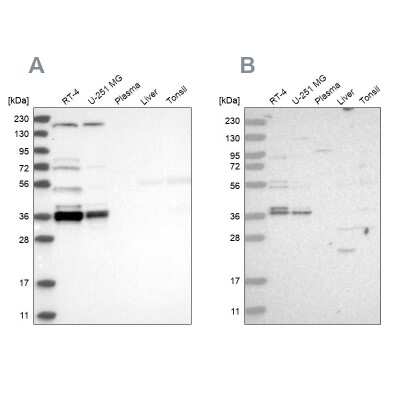 Western Blot: C1orf131 Antibody [NBP1-85097]