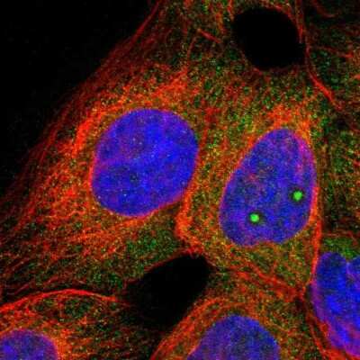 Immunocytochemistry/ Immunofluorescence: C1orf159/RIVIG Antibody [NBP1-93971]
