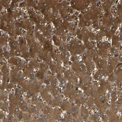 Immunohistochemistry-Paraffin: C1orf159/RIVIG Antibody [NBP1-93971]