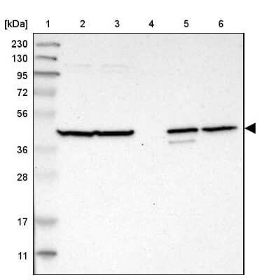Western Blot: C1orf159/RIVIG Antibody [NBP1-93971]