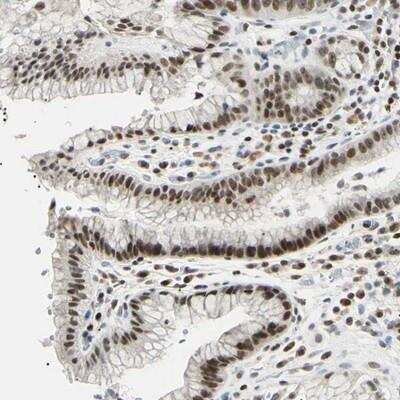 Immunohistochemistry-Paraffin: C1orf174 Antibody [NBP1-87116]
