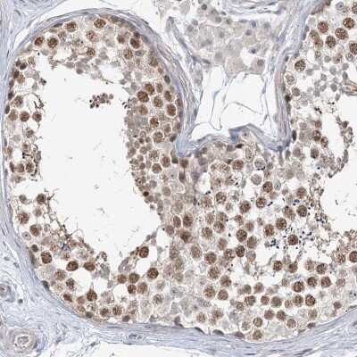 Immunohistochemistry: Lymphocyte Expansion Molecule Antibody [NBP2-32711]