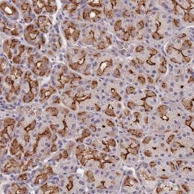 Immunohistochemistry-Paraffin: C1orf189 Antibody [NBP2-14556]