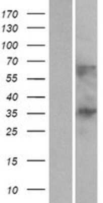 Western Blot: C1orf198 Overexpression Lysate [NBP2-05938]