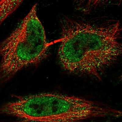 Immunocytochemistry/ Immunofluorescence: C1orf216 Antibody [NBP2-58717]
