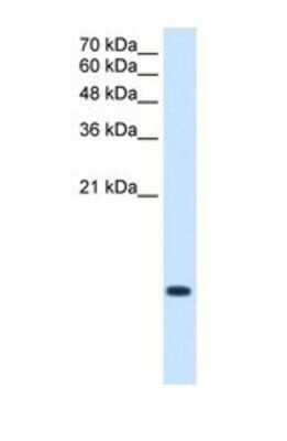 Western Blot: BRICK1 Antibody [NBP1-56944]