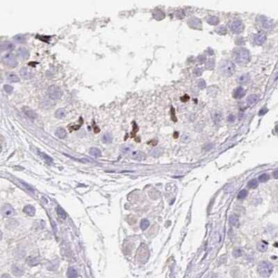 Immunohistochemistry-Paraffin: CFAP74 Antibody [NBP1-91037]