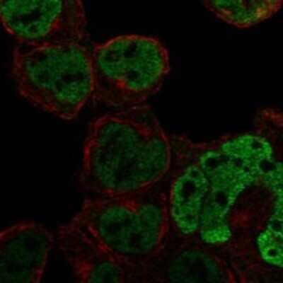 Immunocytochemistry/ Immunofluorescence: C1orf226 Antibody [NBP3-17571]