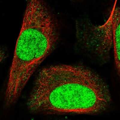 Immunocytochemistry/ Immunofluorescence: C1orf52 Antibody [NBP1-93751]