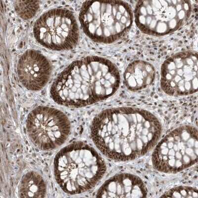 Immunohistochemistry-Paraffin: C1orf52 Antibody [NBP1-93751]