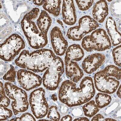 Immunohistochemistry: IBA57 Antibody [NBP2-48594]