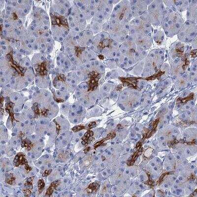 Immunohistochemistry-Paraffin: FAAP20 Antibody [NBP1-93890]